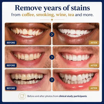 Haute Teeth Whitening Stick