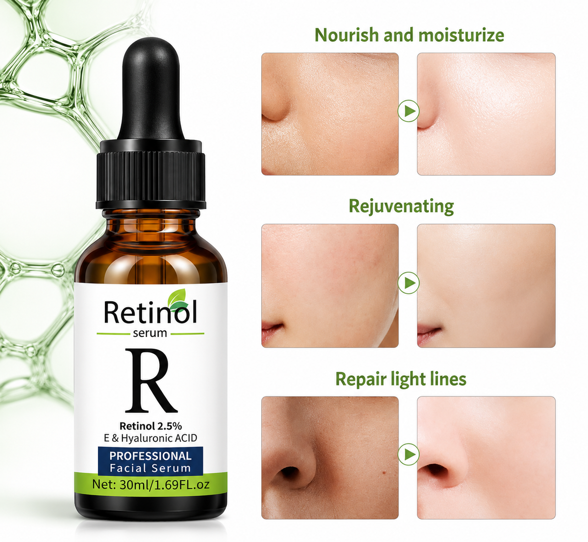 Vitamin C, Retinol and Hyaluronic Acid Serum - Complete Skincare Solution